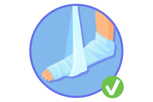 Hand in Plaster Cast: An Embroidery Designer’s Honest Review
